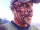 Man survives two attacks by sow grizzly bear