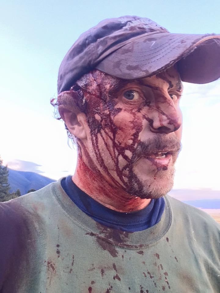 Man survives two attacks by sow grizzly bear